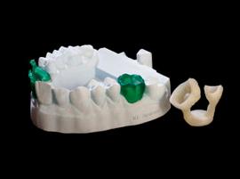 3D-печатные зубные протезы от 3D Shape и 3D Systems