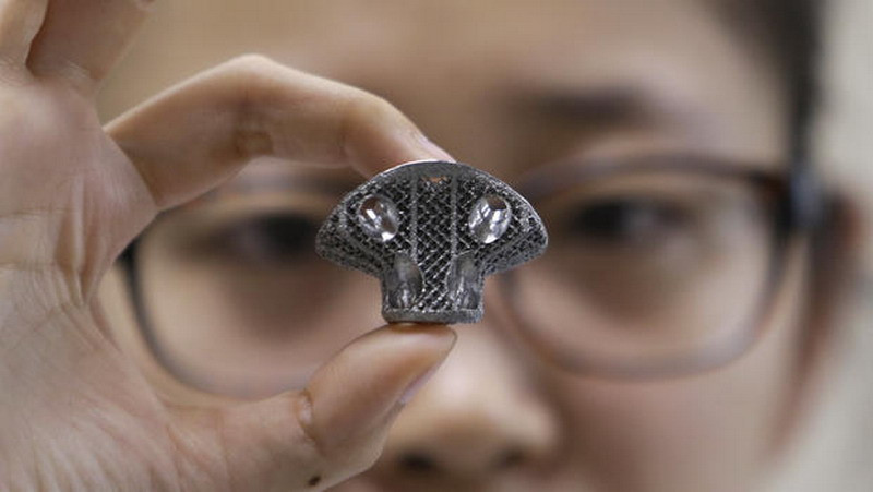 В Китае проведена первая в мире успешная имплантация позвонка, напечатанного на 3D-принтере.