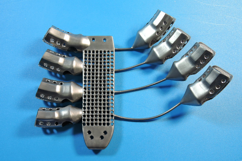 В Испании провели первую в мире операцию по пересадке рёбер, напечатанных на 3D-принтере.