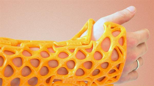 3D-печатные ортезы «Здравпринт» приходят на смену гипсовым слепкам
