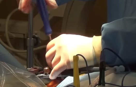 3D-печатные спинальные имплантаты K2M даруют пациентам надежду на жизнь без боли
