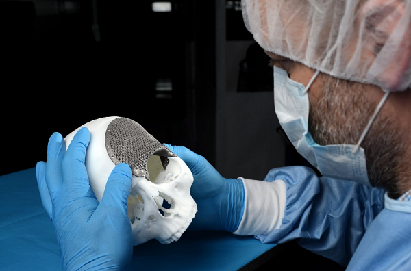 Новосибирские врачи используют 3D-печатные титановые имплантаты