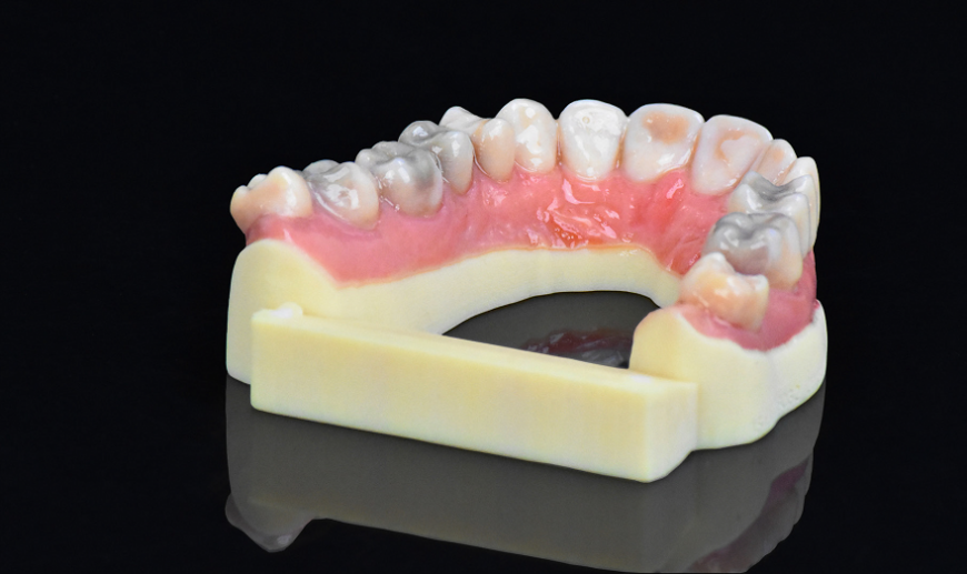 Stratasys анонсировала цветной стоматологический 3D-принтер J720 Dental