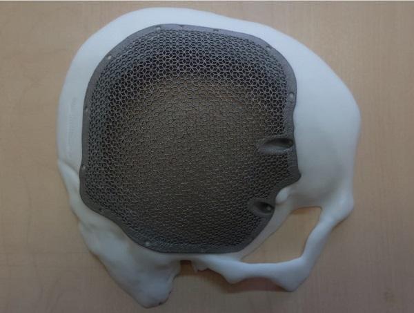 Красноярские хирурги осваивают 3D-технологии