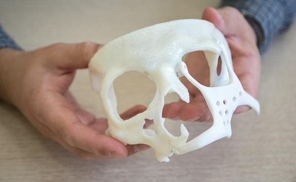 Томские хирурги используют создаваемые с помощью 3D-принтеров имплантаты из нанокерамики