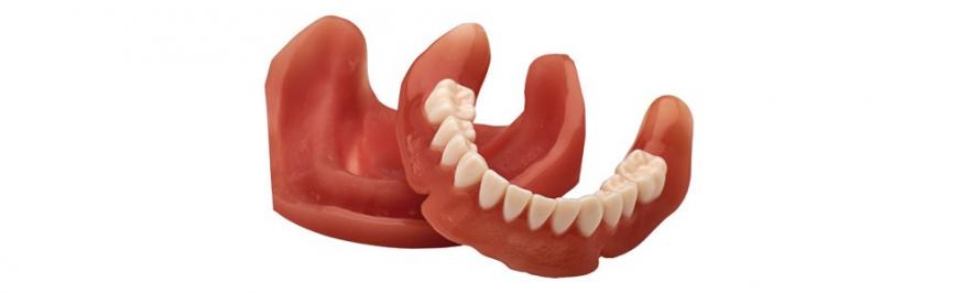3D-печать в стоматологии на примере NextDent