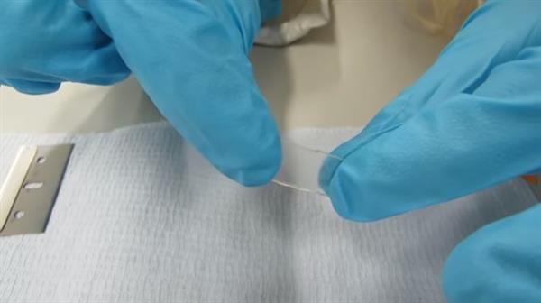 Британские ученые создали 3D-печатное амортизирующее биостекло для изготовления хрящевых имплантатов