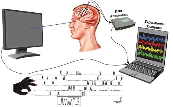 3D-принтеры и электрокортикография: иранские ученые исследуют тайны головного мозга