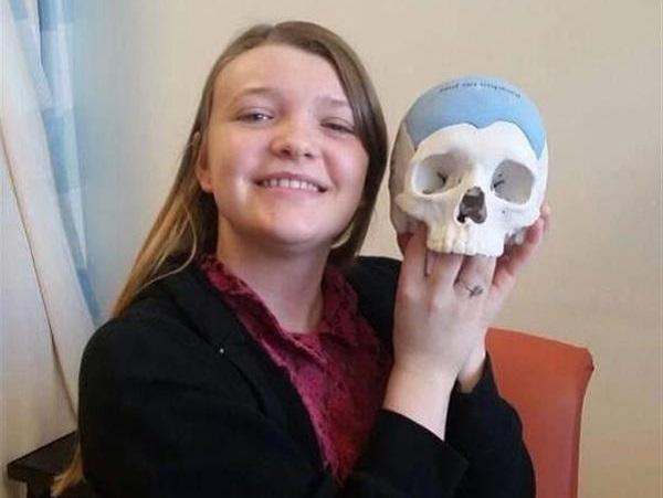 Британка получила 3D-печатный черепной имплантат после сложной операции