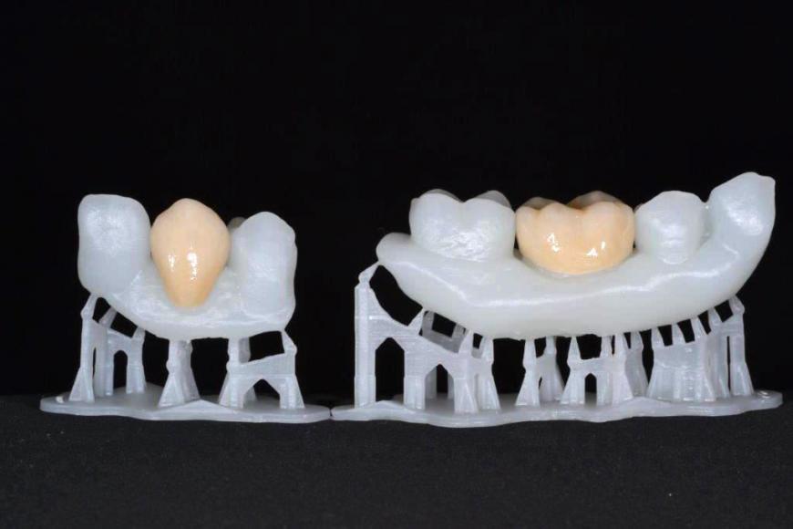 Противомикробные зубные протезы