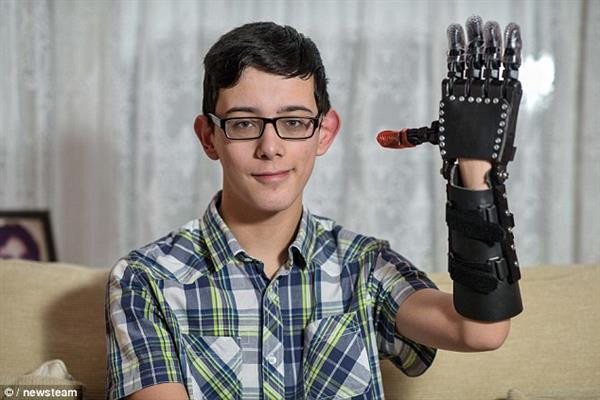 Подросток получил 3D-печатный протез руки в стиле «Звездных войн»