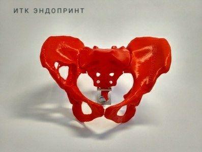 Кейс: 3D принтеры Hercules штурмуют рынок протезирования