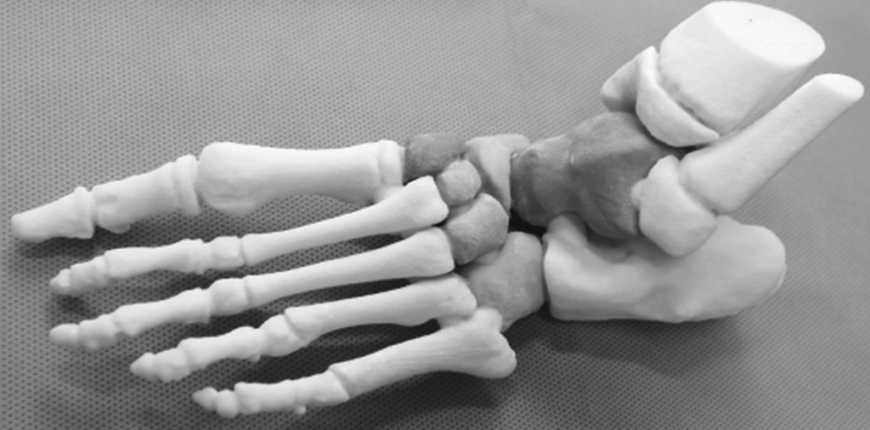 Китайские ученые печатают костные имплантаты из костного порошка и биоклея