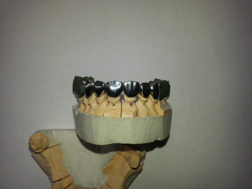 Пробная печать зубных протезов из металла по технологии SLM.
