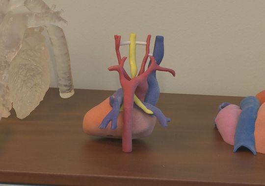 3D-печатная модель сердца помогла спасти жизнь 20-месячного мальчика