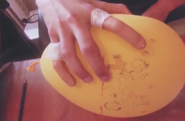 Курганские ученые провели успешные испытания вживляемых 3D-печатных протезов пальцев