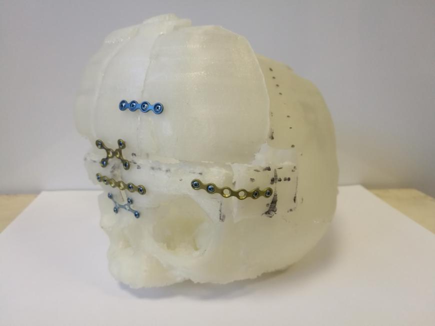 Применение 3D-печати в детской нейрохирургии.