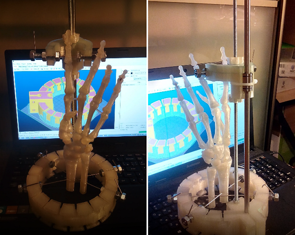 Врачи-печатники, или Как участник 3Dtoday применяет 3D-принтеры в медицинской практике