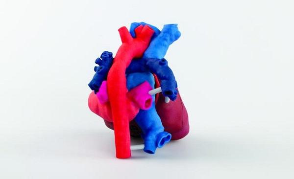 3D Systems помогает детским кардиохирургам бесплатными анатомическими макетами