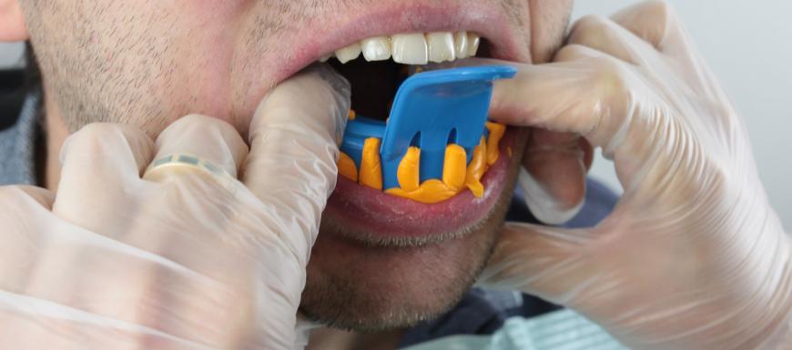 Производство стоматологических элайнеров при помощи Uniz Slash Plus
