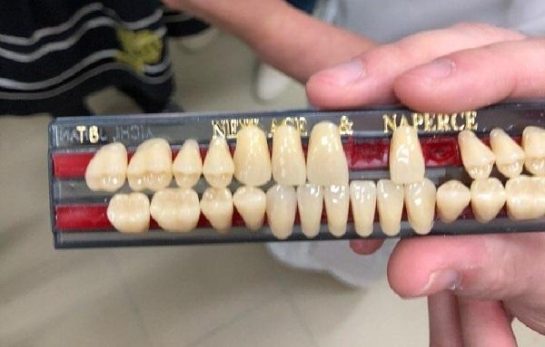 Студенты СПбГУ разрабатывают материал для 3D-печати зубных коронок