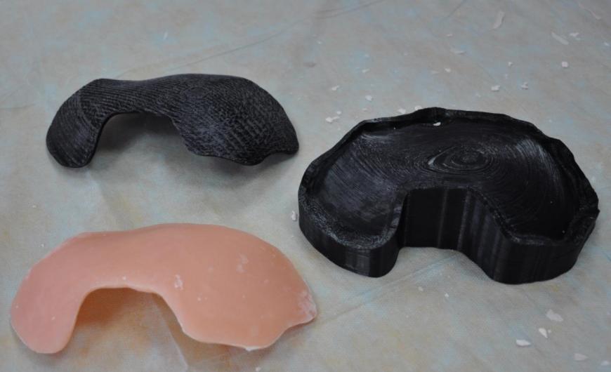 Применение 3D-печати в краниопластике