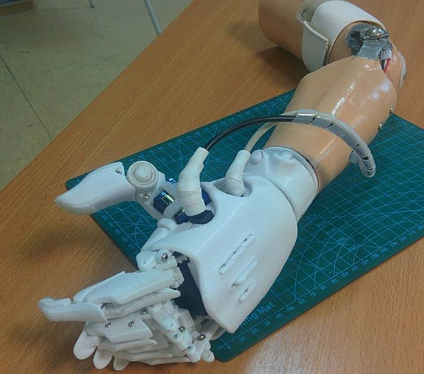 Инженеры из Республики Саха используют 3D-печать в производстве бионических протезов