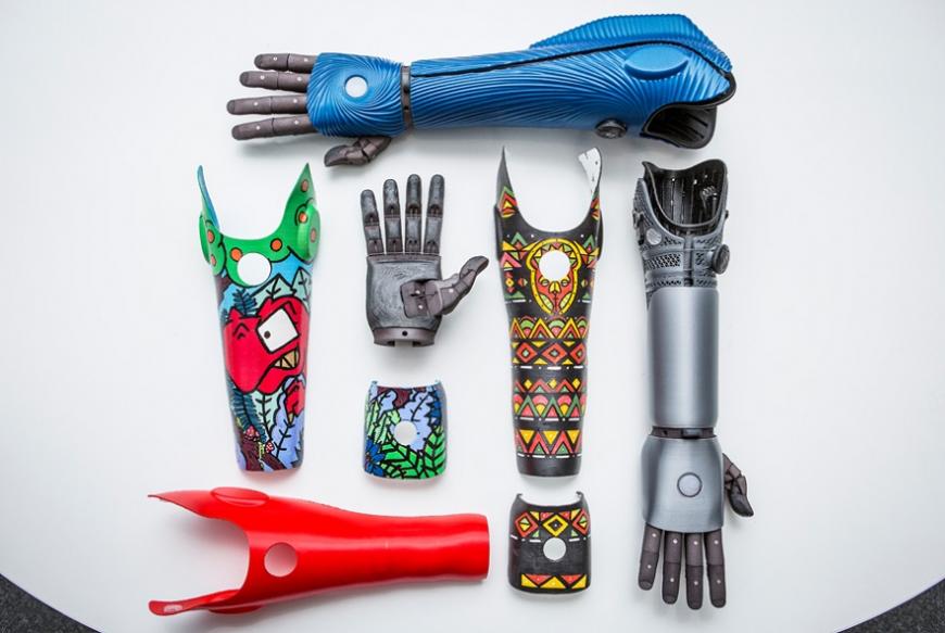 Разработчик 3D-печатных протезов Open Bionics намеревается выйти на международный рынок