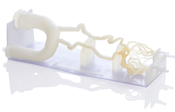 3D-печатные хирургические модели снижают уровень детской смертности