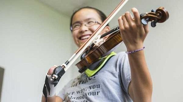3D-печатный протез помогает 14-летней девочке играть на скрипке