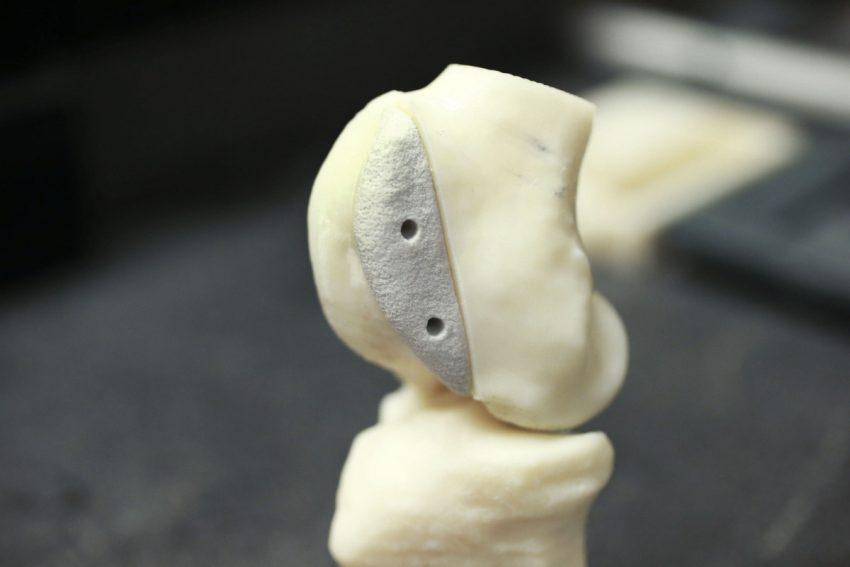 Инженер из Университета Уотерлу разработала 3D-принтер для изготовления костных и хрящевых имплантатов