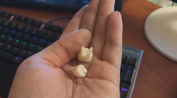 Студенты СПбГУ разрабатывают материал для 3D-печати зубных коронок