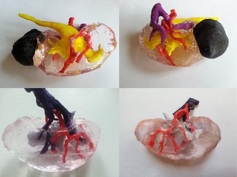 3D печать в медицине