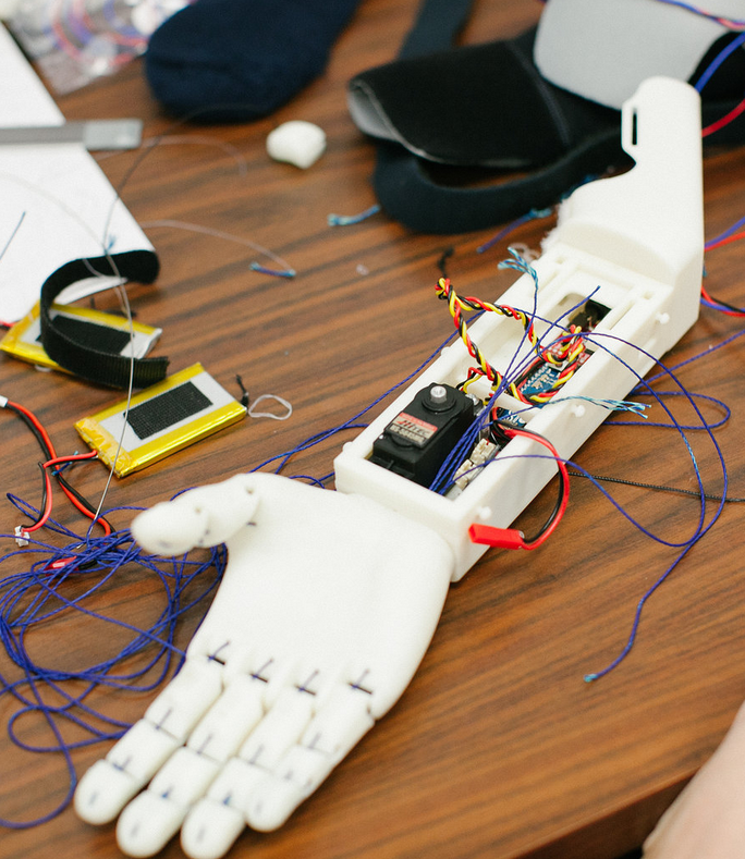 6-летний мальчик стал первым в мире обладателем 3D-печатной миоэлектрической руки