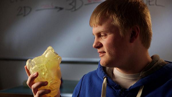 3D-печатная модель опухоли на сердце помогла врачам спланировать лечение 16-летнего пациента
