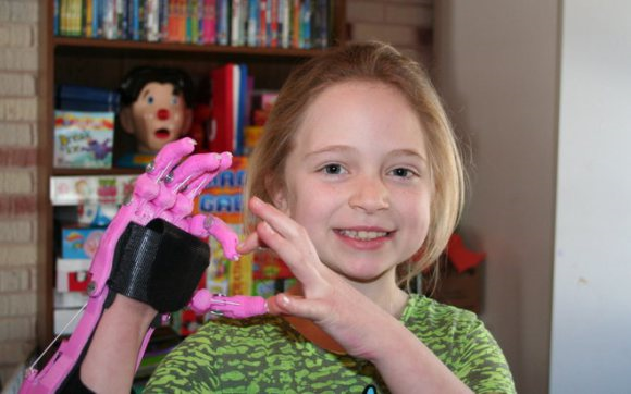 Онлайн сообщество создало 3D-печатную руку для 9-летней девочки