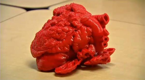 3D-печатное сердце