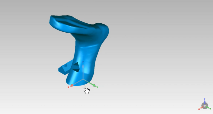 Реальное применение: 3D-сканирование в ортопедической практике