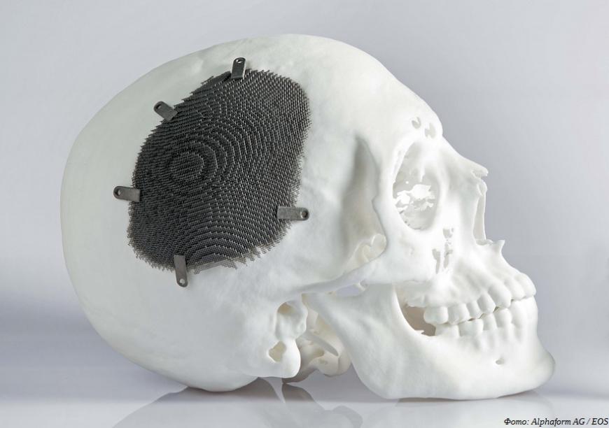 Резидент технопарка «Мосгормаш» стал сертифицированным производителем 3D-печатных имплантатов