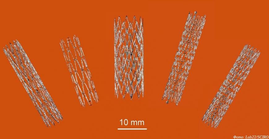 Австралийские ученые создают 3D-печатные стенты из никелида титана