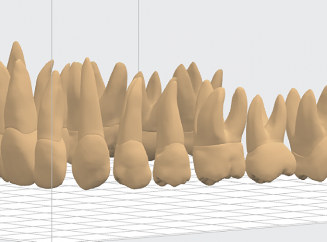 16 зубов верхней челюсти полной анатомии