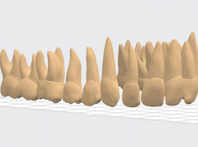 16 зубов верхней челюсти полной анатомии