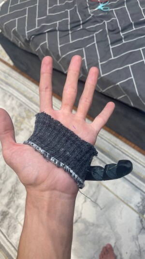 6-ой палец из TPU