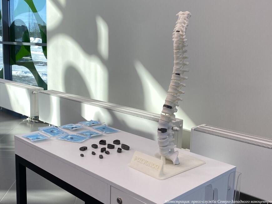 Российские 3D-печатные имплантаты появятся в поликлиниках