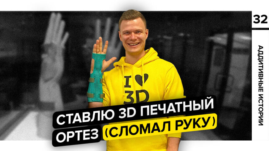 Ставлю 3D печатный ортез (сломал руку)