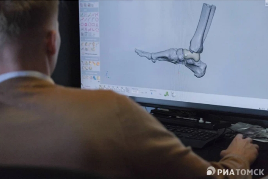 В ТУСУР разрабатывают 3D-печатные костные имплантаты из керамики В ТУСУР разрабатывают 3D-печатные костные имплантаты из керамики
