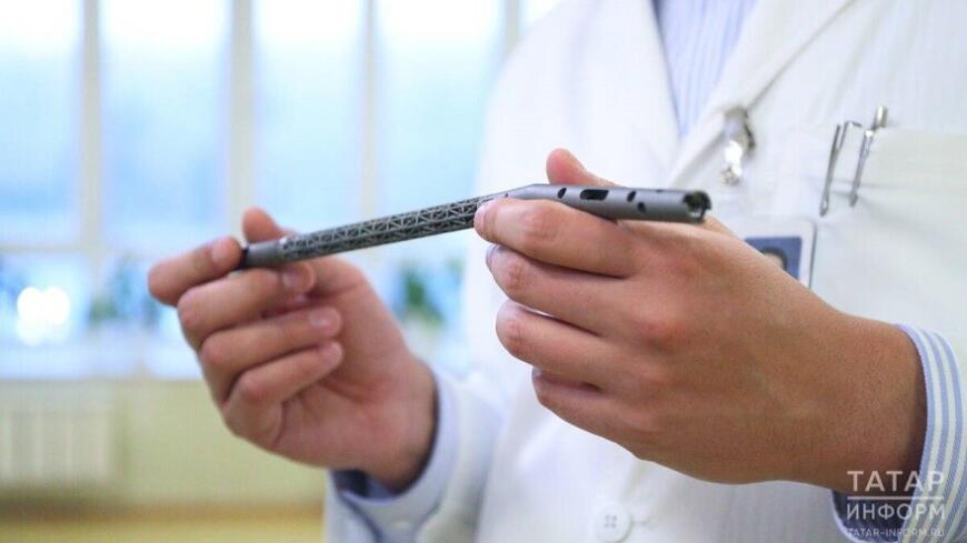 Казанские ученые разработали 3D-печатные штифты для лечения инфицированных переломов