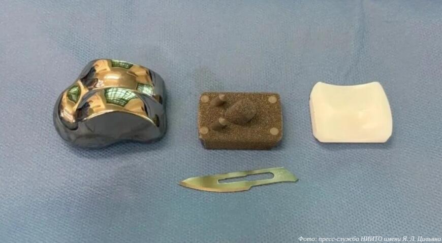 Новосибирские врачи провели операцию по замене таранной кости 3D-печатным имплантатом
