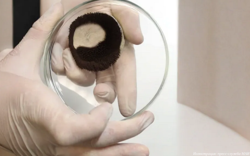 В МАИ разрабатывают систему для удаления почечных камней