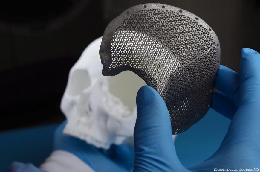 Новосибирская компания Logeeks нарастит производство 3D-печатных имплантатов вдвое